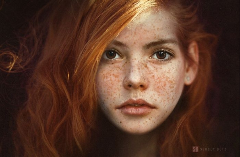 16 fascinantes fotos de personas con pecas