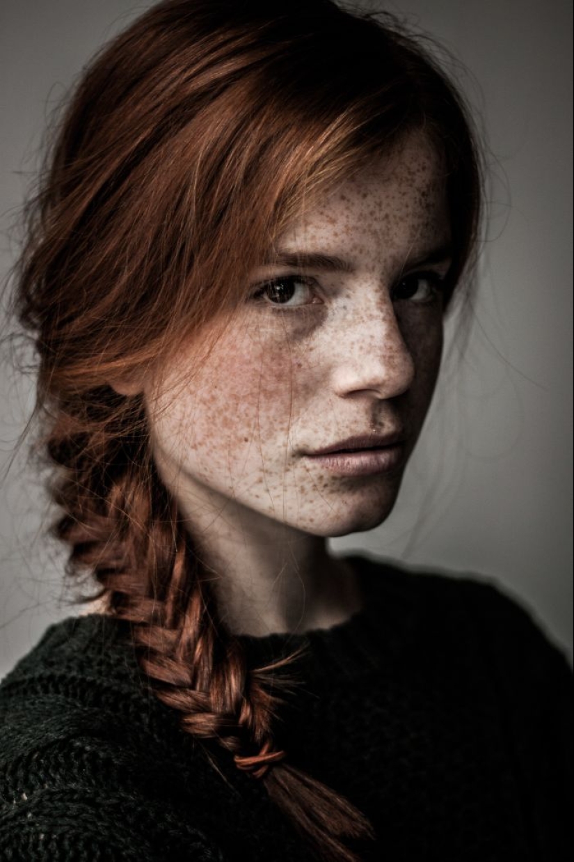 16 fascinantes fotos de personas con pecas