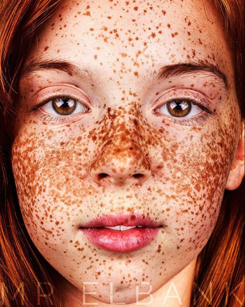 16 fascinantes fotos de personas con pecas