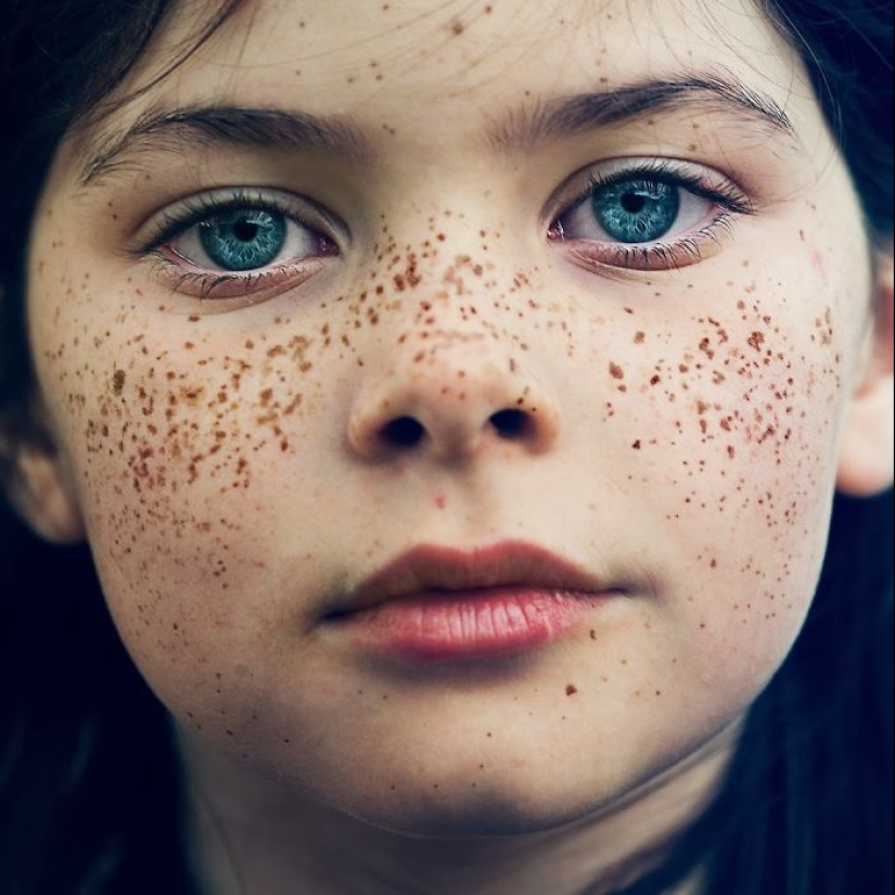 16 fascinantes fotos de personas con pecas