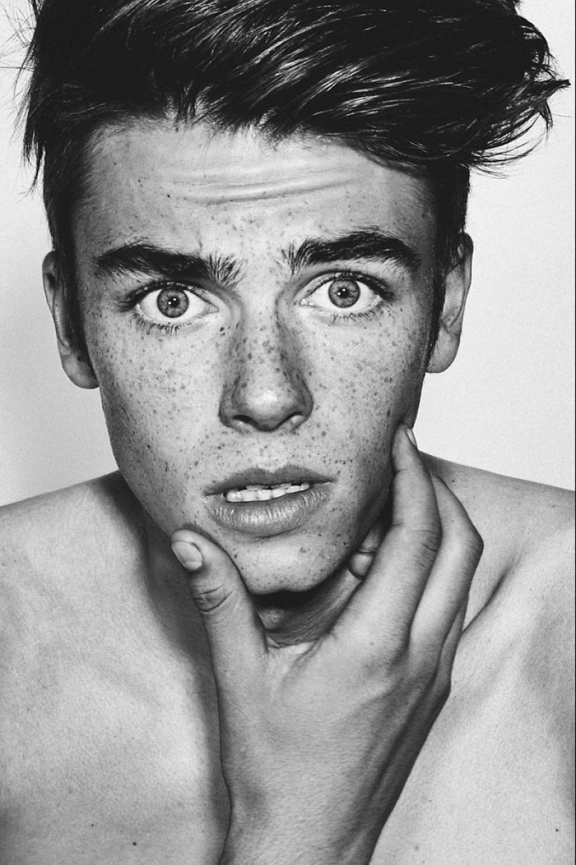 16 Mesmerizing Photos of People with Freckles