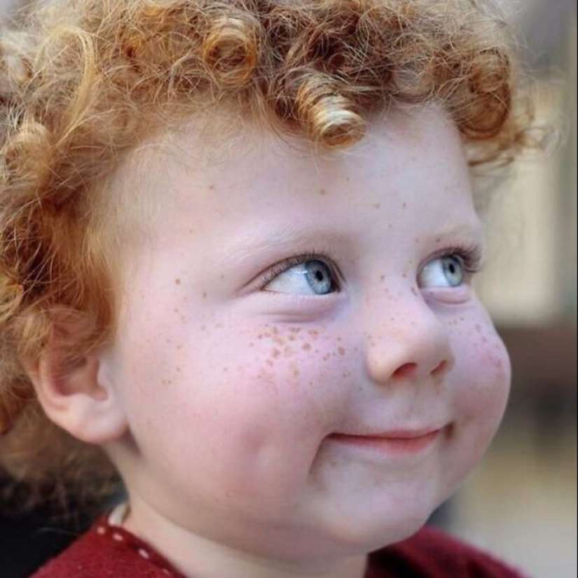 16 Mesmerizing Photos of People with Freckles