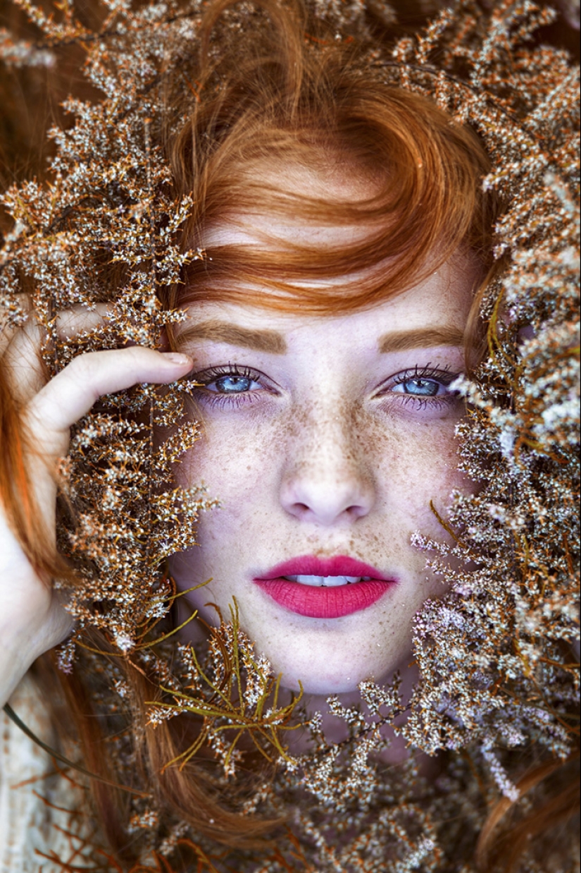 16 Mesmerizing Photos of People with Freckles