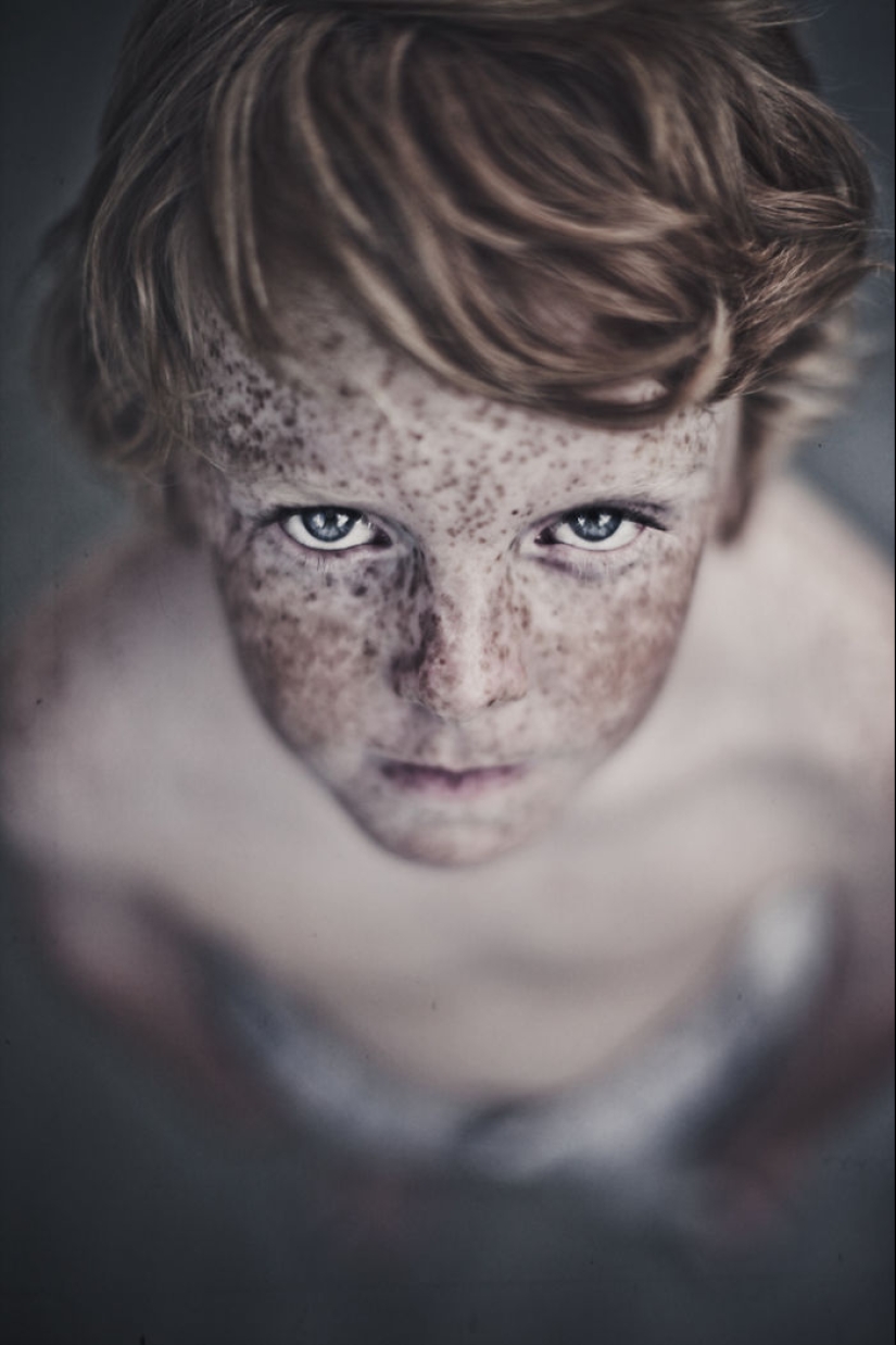 16 Mesmerizing Photos of People with Freckles