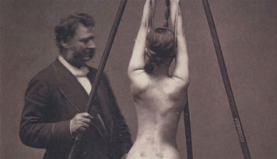 18 simultaneously frightening and fascinating photos of the medicine of the past