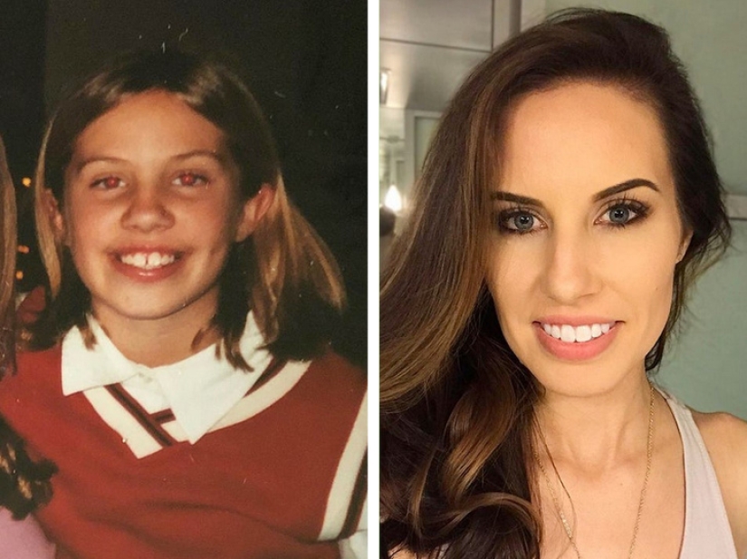 20 photos of the amazing transformations that inspire and motivate