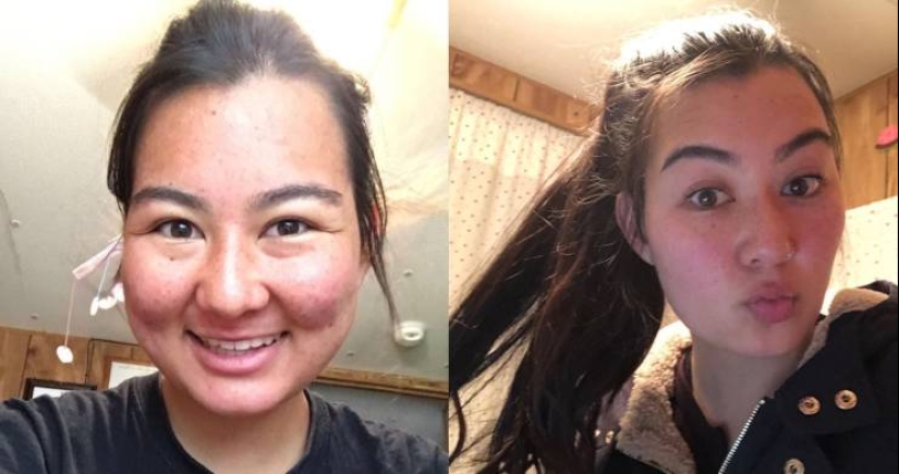 25 successful transformations from an ugly duckling to a beautiful Swan