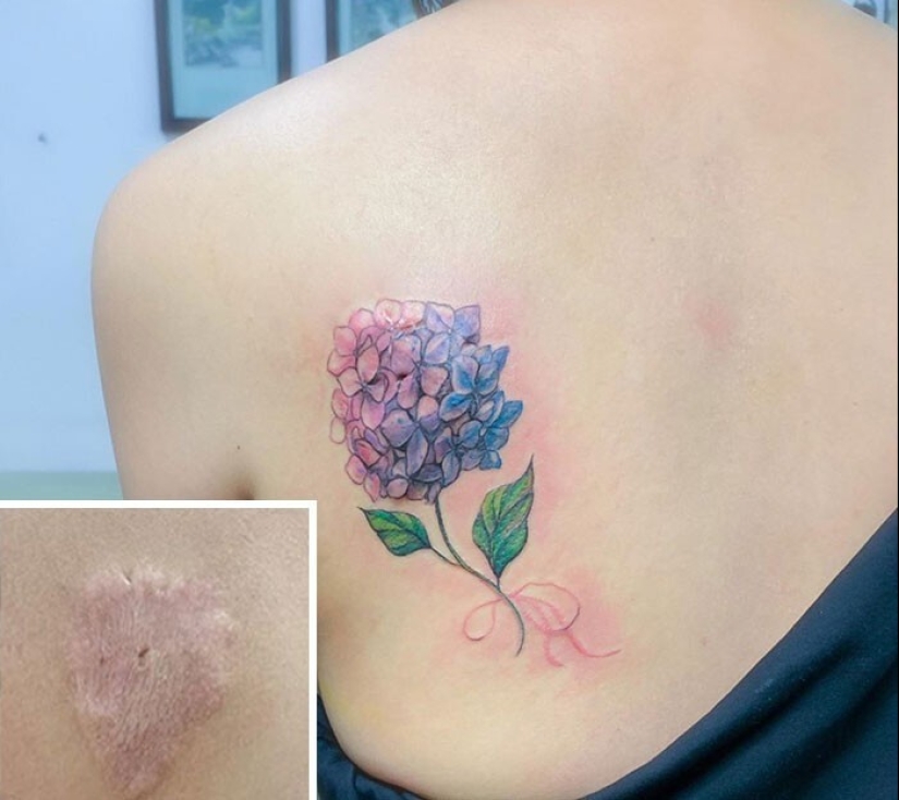 25 tattoos to cover scars and other defects on the body