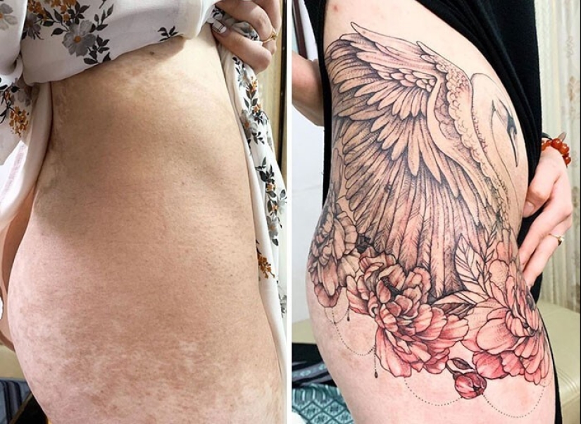 25 tatuajes para cubrir cicatrices y otros defectos en el cuerpo