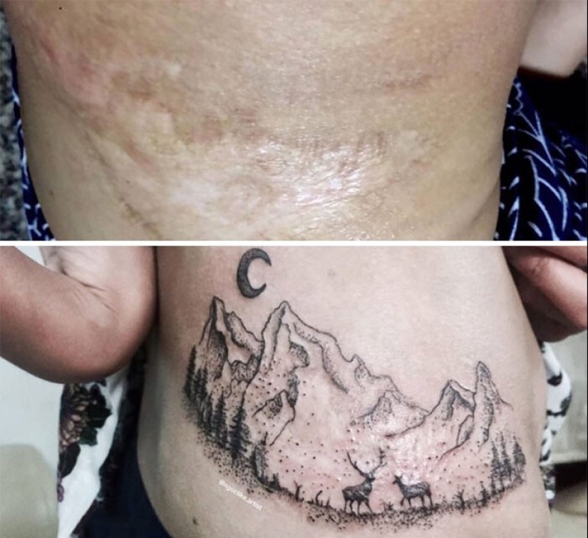 25 tatuajes para cubrir cicatrices y otros defectos en el cuerpo