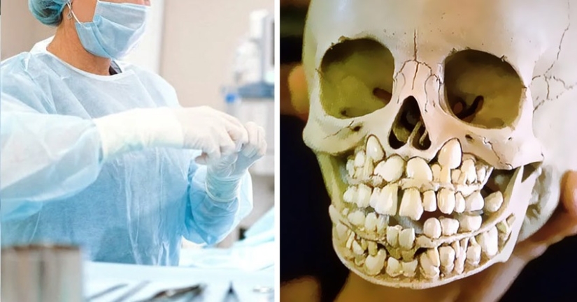 25 weird, creepy and creepy facts about the human body