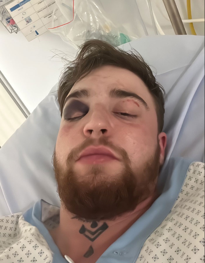 29-Year-Old Trans Man Gets Brutally Beaten Up In Switzerland, Claims It’s A Hate Crime