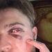 29-Year-Old Trans Man Gets Brutally Beaten Up In Switzerland, Claims It’s A Hate Crime