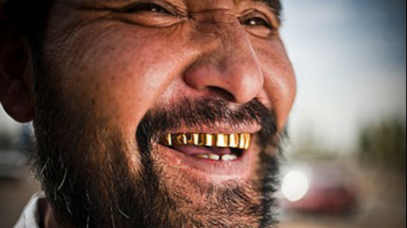 3 Reasons why Gypsies Give themselves Gold Teeth