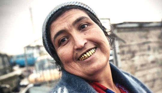 3 Reasons why Gypsies Give themselves Gold Teeth