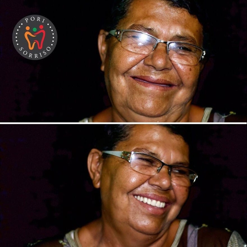 30 fotos antes y después de que la gente recuperara su sonrisa