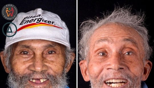 30 fotos antes y después de que la gente recuperara su sonrisa