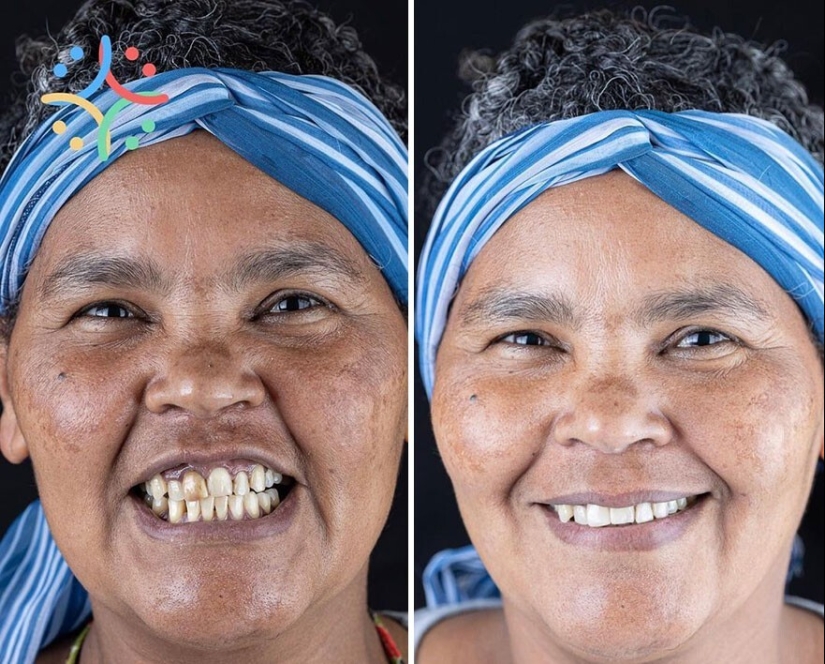 30 fotos antes y después de que la gente recuperara su sonrisa