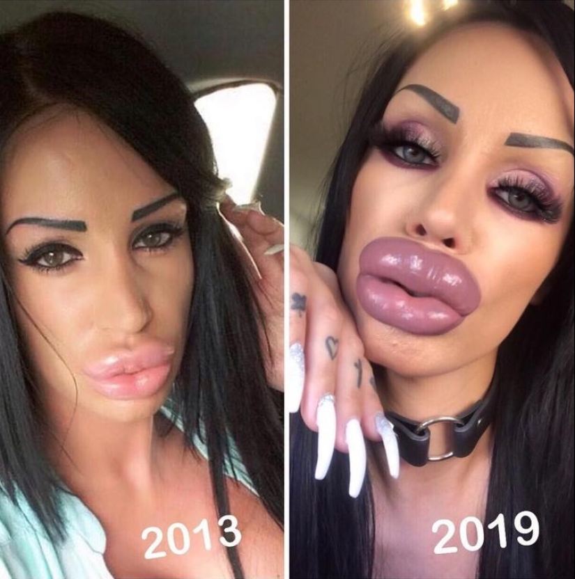 30 people who got carried away with plastic surgery and forgot to stop