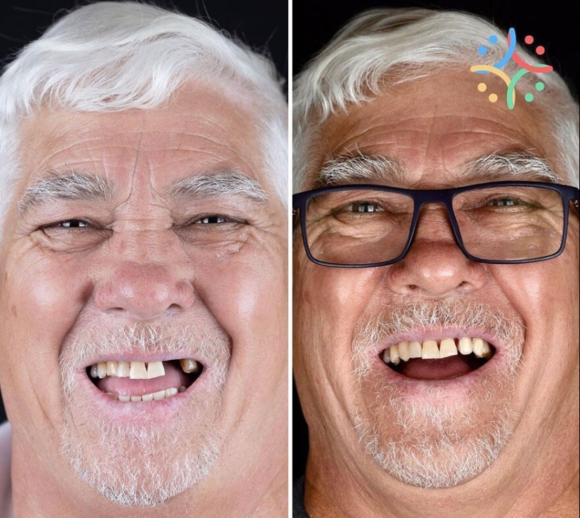 30 photos before and after people got their smile back