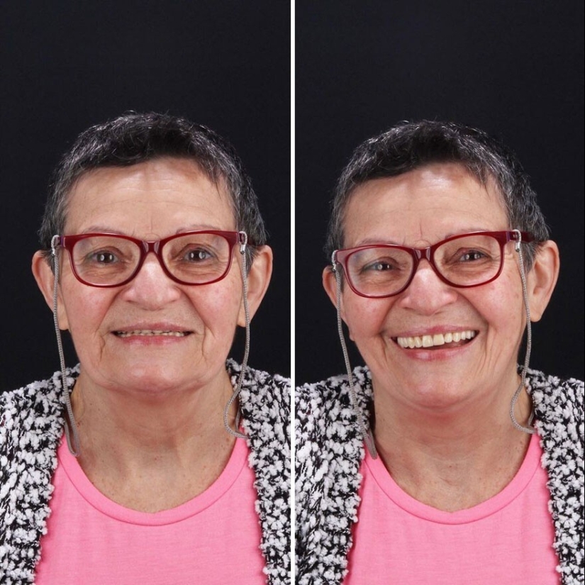 30 photos before and after people got their smile back