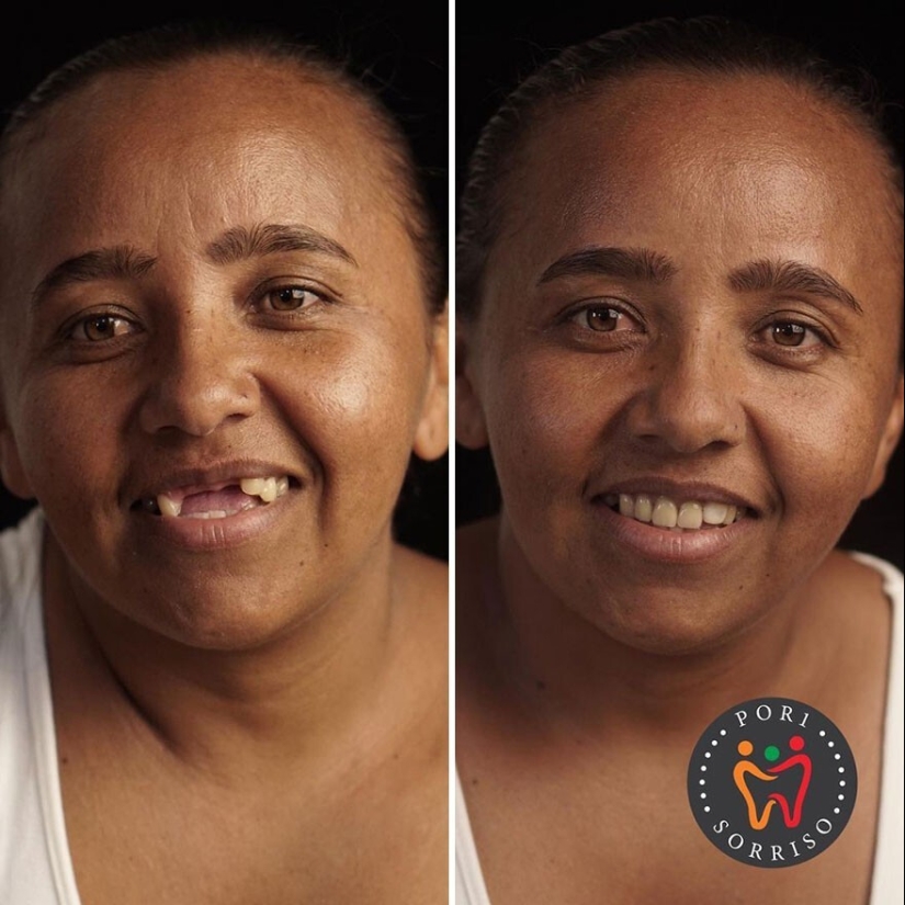 30 photos before and after people got their smile back