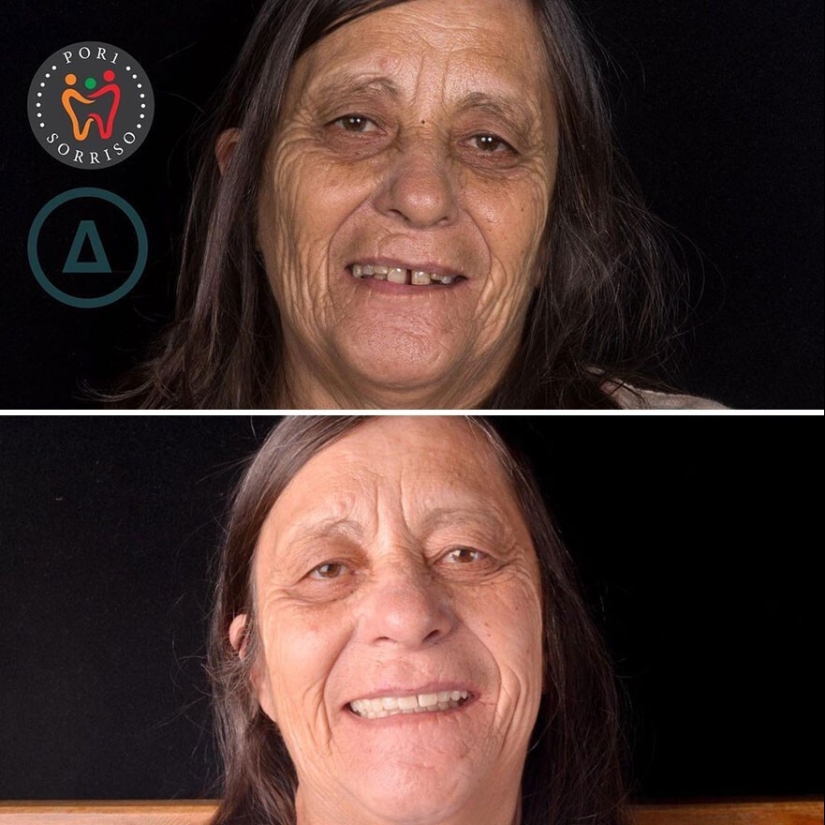 30 photos before and after people got their smile back