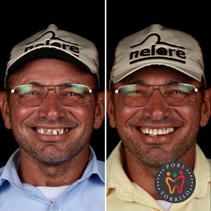 30 photos before and after people got their smile back