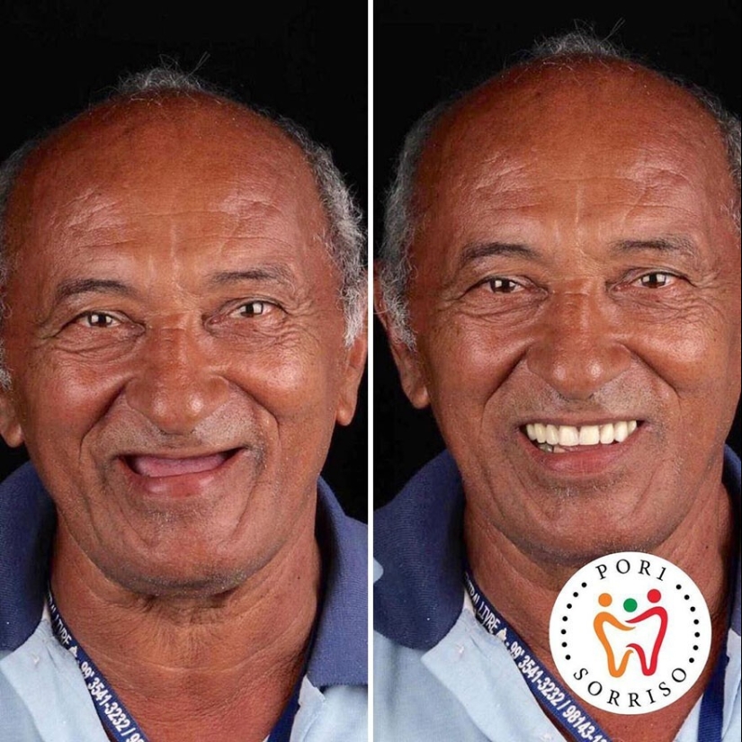 30 photos before and after people got their smile back