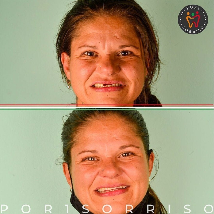 30 photos before and after people got their smile back