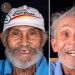 30 photos before and after people got their smile back