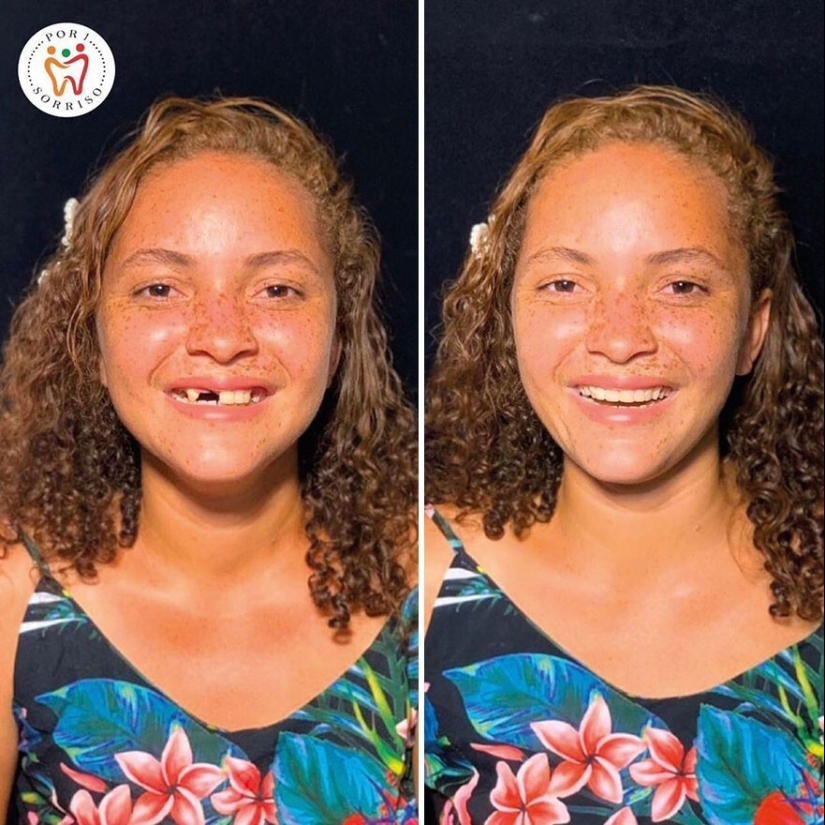 30 photos before and after people got their smile back