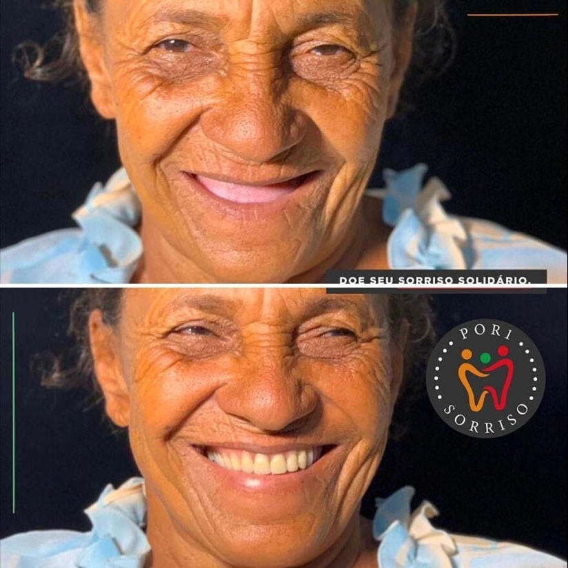 30 photos before and after people got their smile back