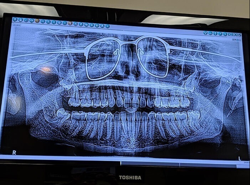 35 x-ray images that reveal the world from an unexpected quarter