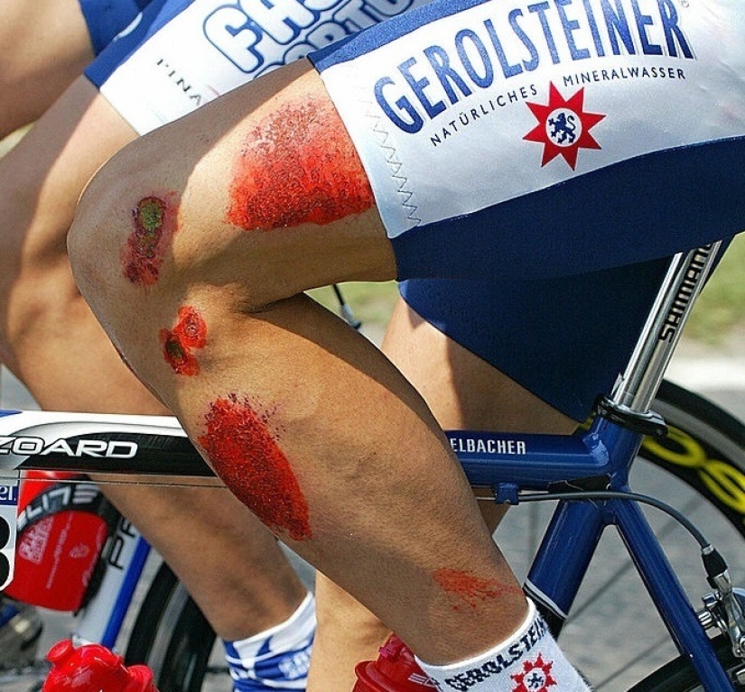 5 reasons why cyclists shave their legs