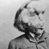 A Freak with a Beautiful Soul: The Story of Joseph Merrick-The Elephant Man