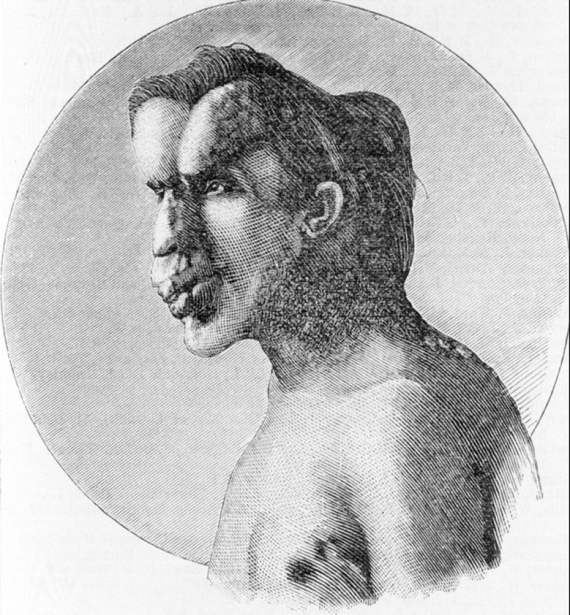 A Freak with a Beautiful Soul: The Story of Joseph Merrick-The Elephant Man