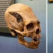 A human skull bonded with metal 2000 years ago amazed scientists