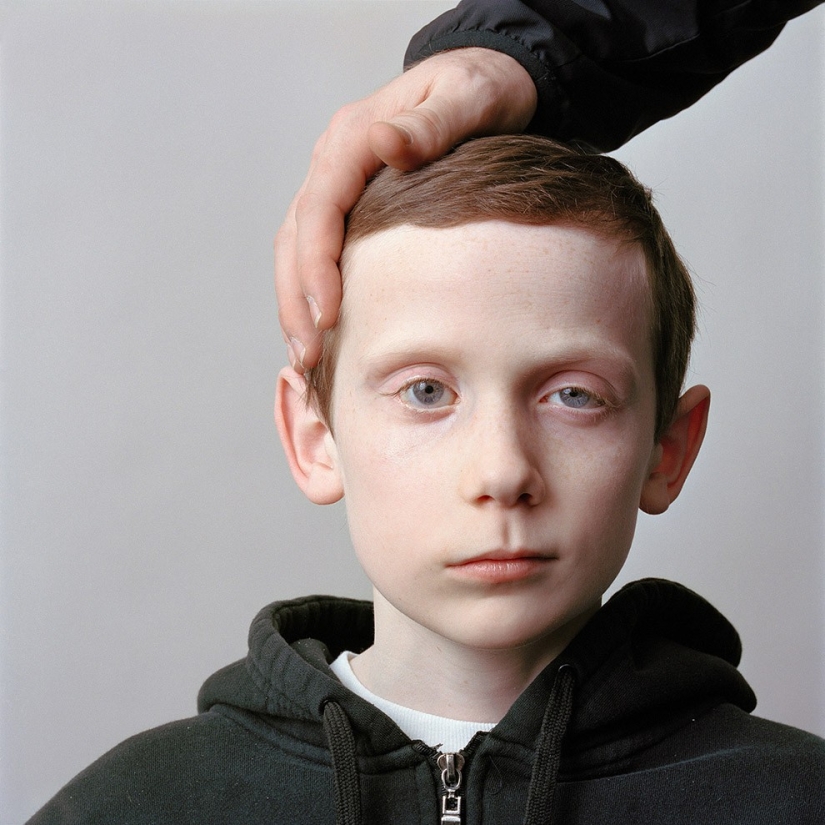 Acerca de la cara: retratos fotográficos de personas que sufren de parálisis