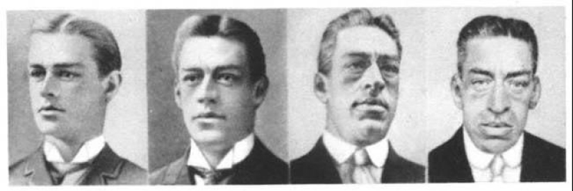 Adam Rainer: the story of an unfortunate guy who managed to be a dwarf and a giant