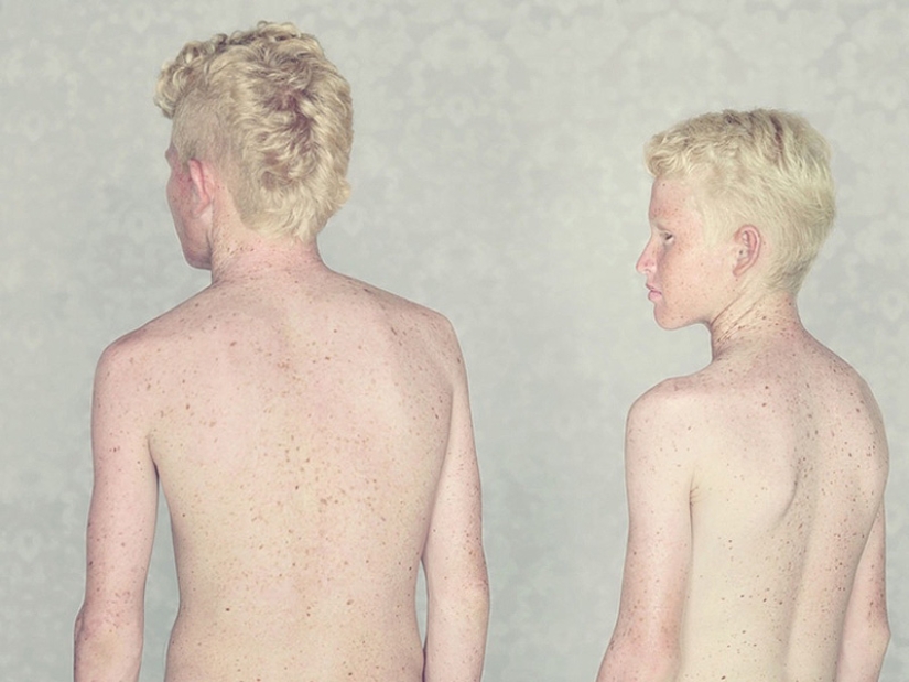 Albinos en la lente de Gustavo Lacerde