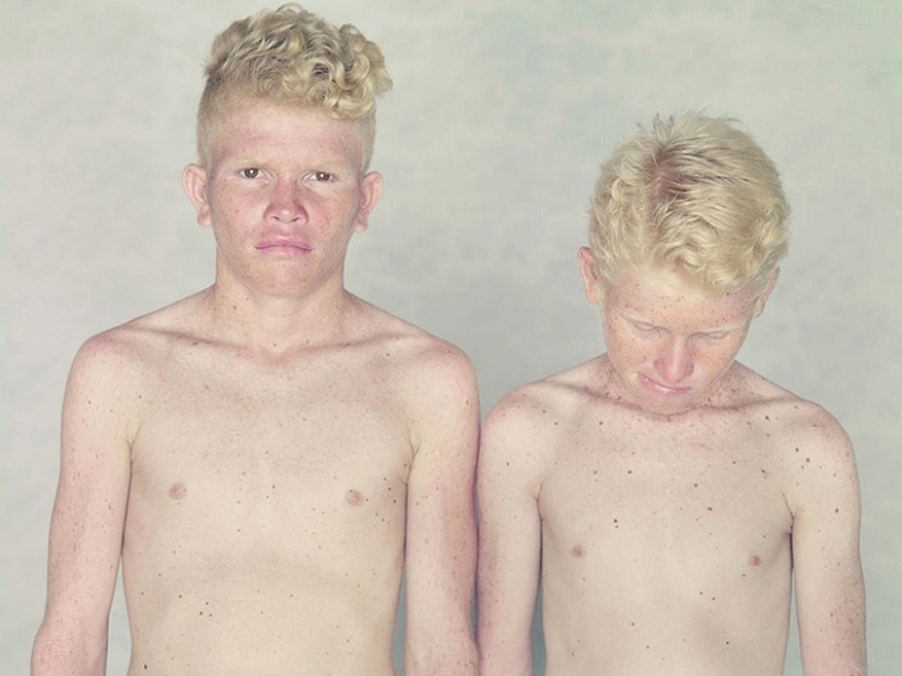 Albinos en la lente de Gustavo Lacerde