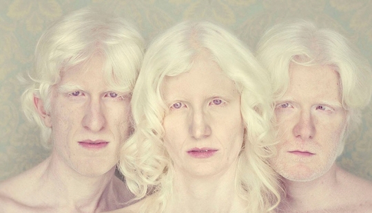 Albinos en la lente de Gustavo Lacerde