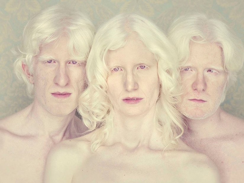 Albinos in the lens of Gustavo Lacerde