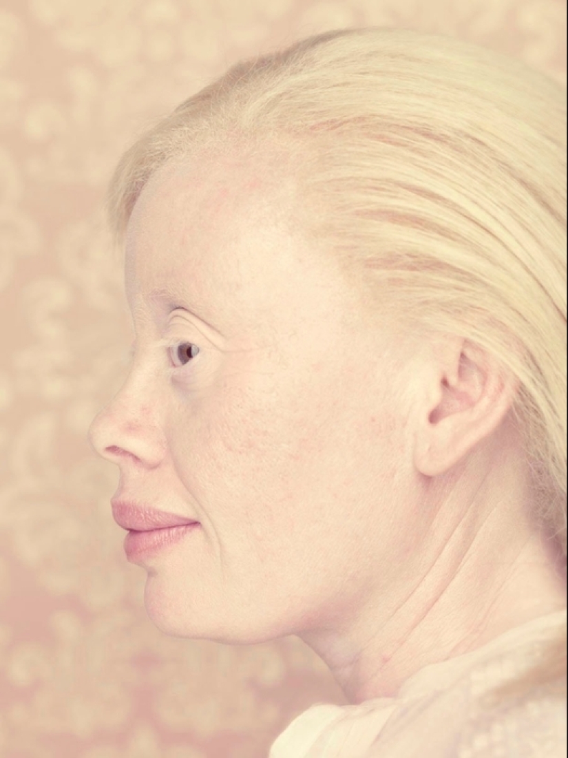 Albinos in the lens of Gustavo Lacerde