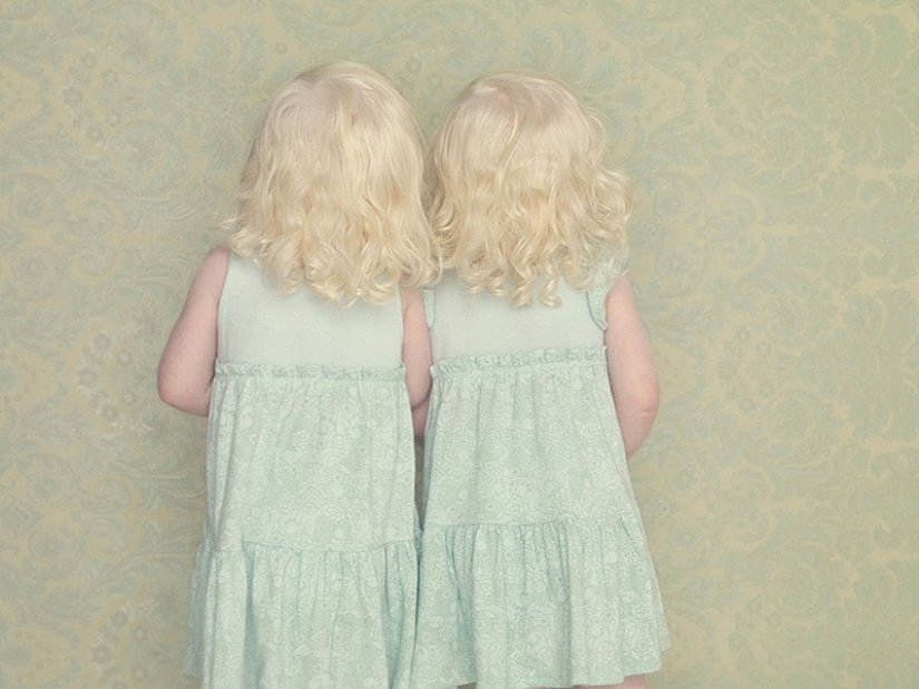 Albinos in the lens of Gustavo Lacerde