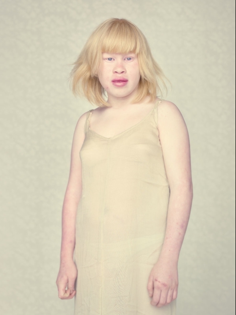 Albinos in the lens of Gustavo Lacerde