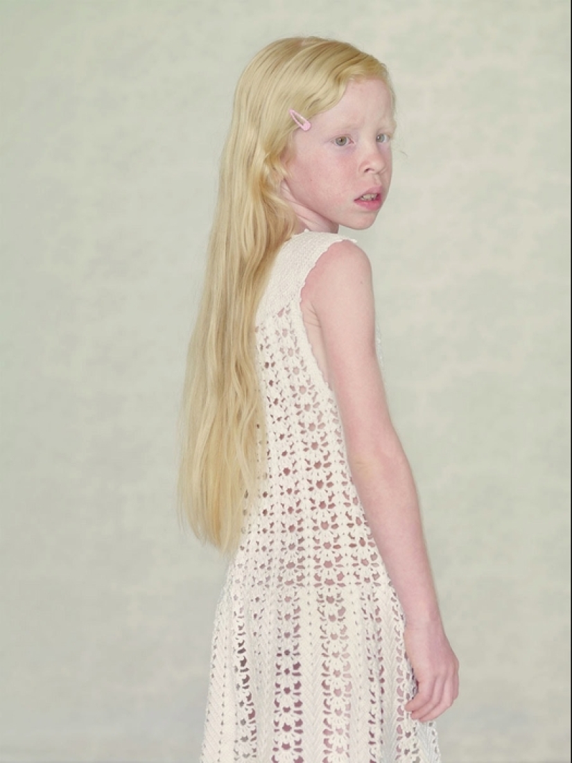 Albinos in the lens of Gustavo Lacerde