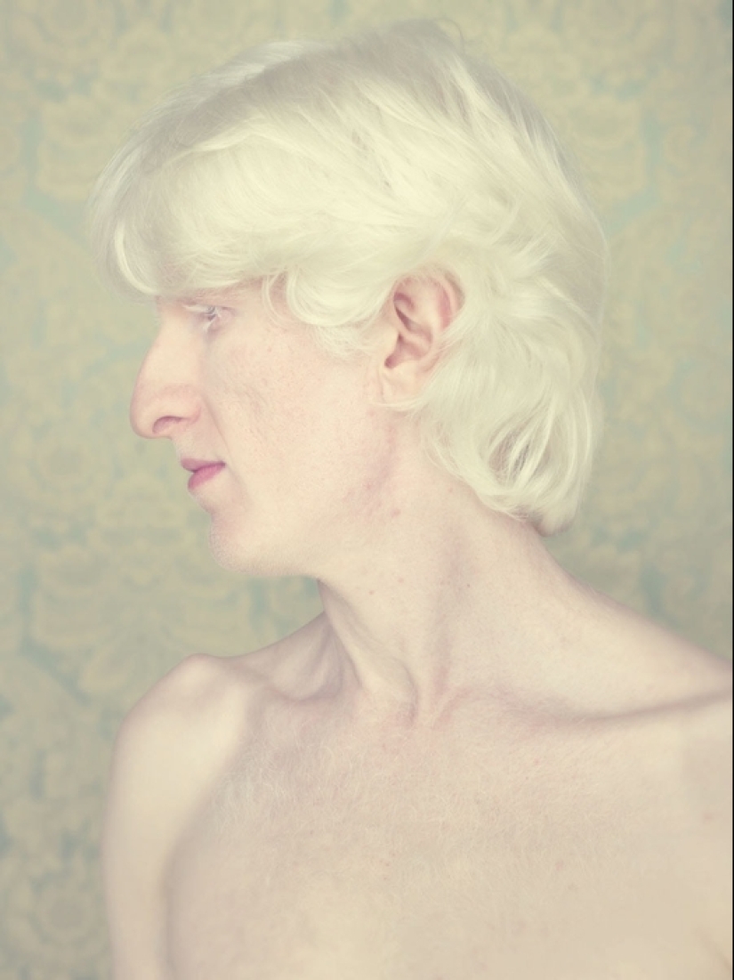 Albinos in the lens of Gustavo Lacerde