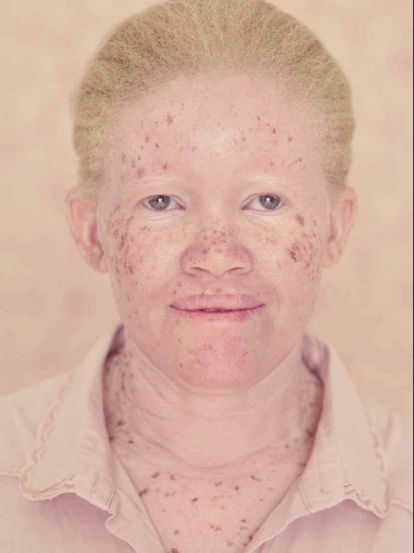 Albinos in the lens of Gustavo Lacerde